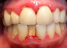 periodoncia